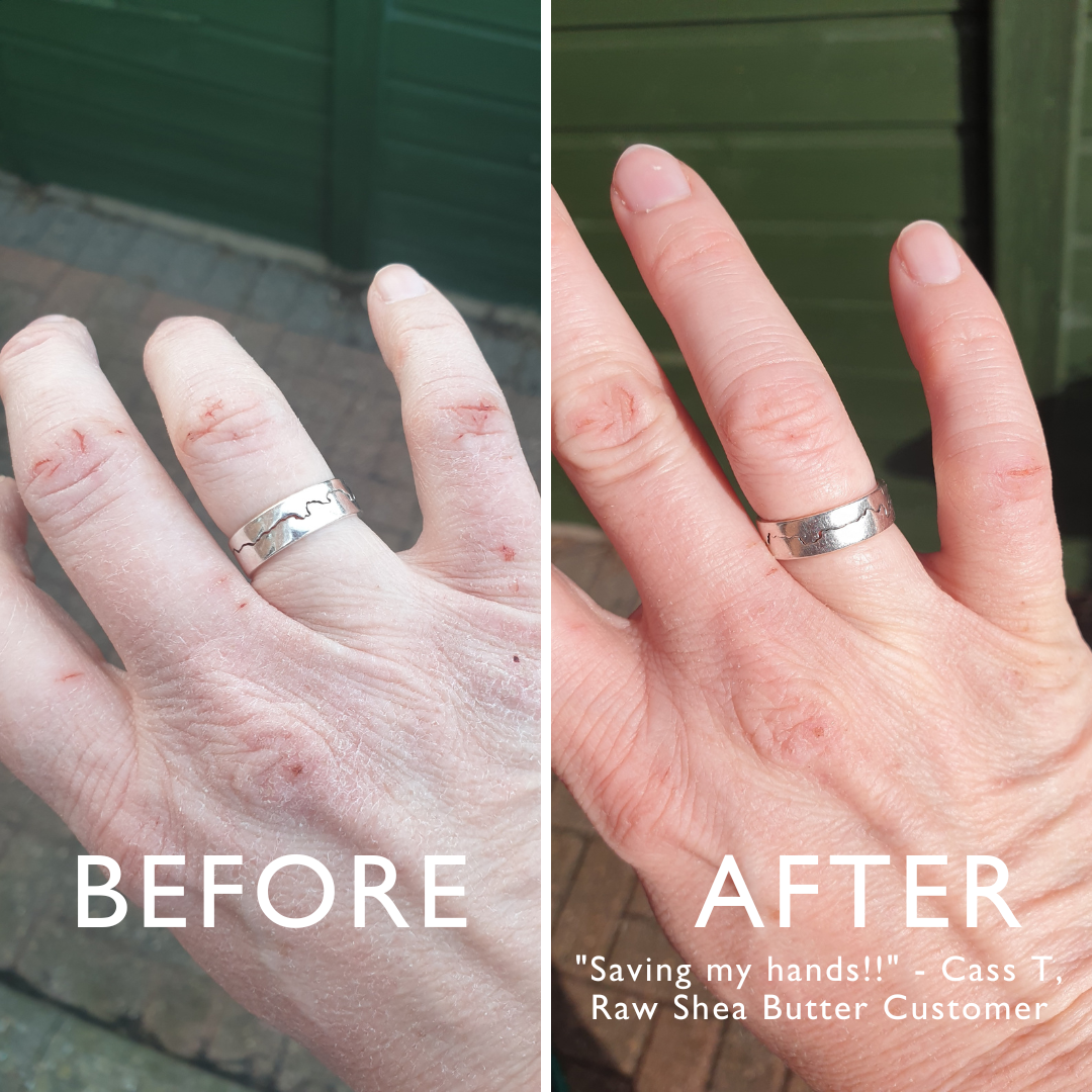 Shea moisture online eczema cream