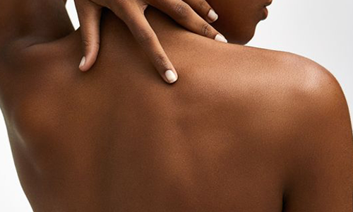 The impact azelaic acid has on your skin